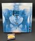 Disque Vinyle Noir SignÉ Lorde Lp SignÉ Autographie Double Variante Rare B